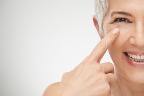 Close up of senior woman showing wrinkles before having CO2 Resurfacing