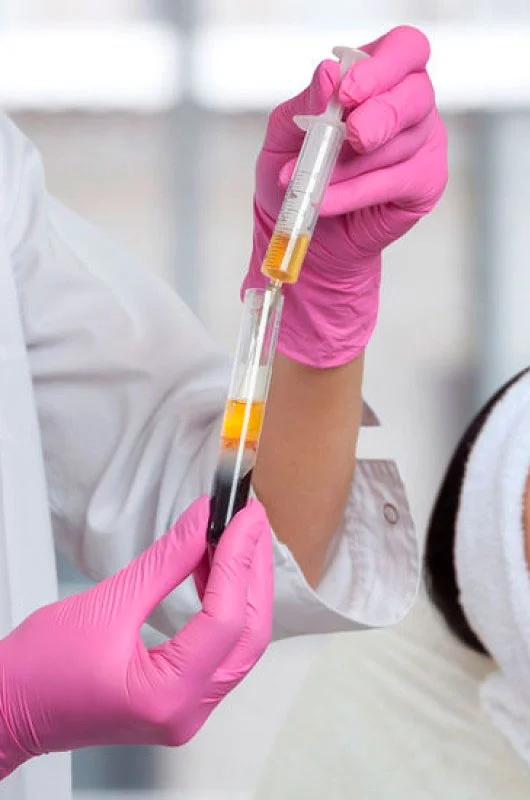 PRP Therapy