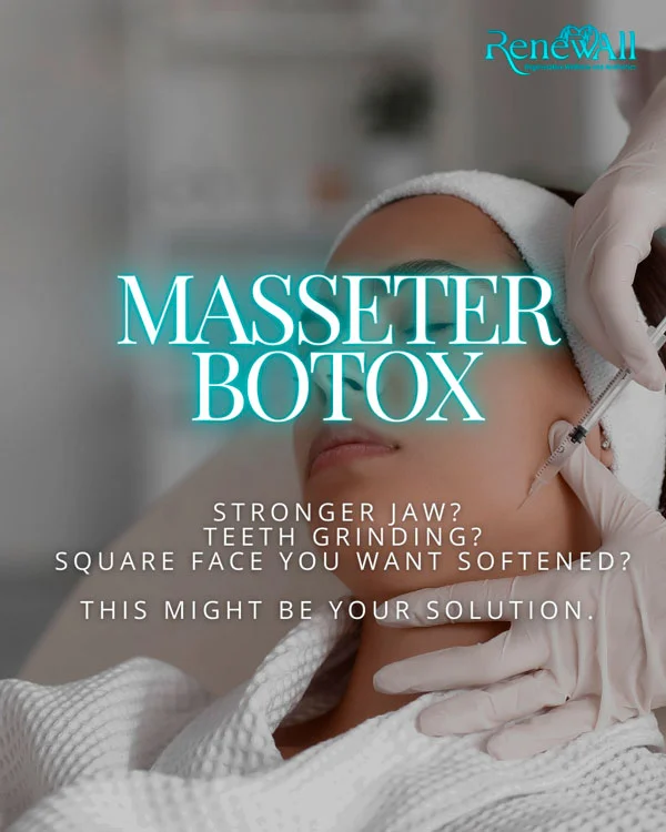 Masseter Botox