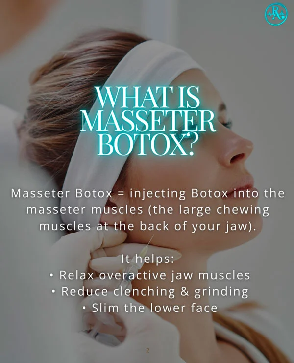 What Is Masseter Botox