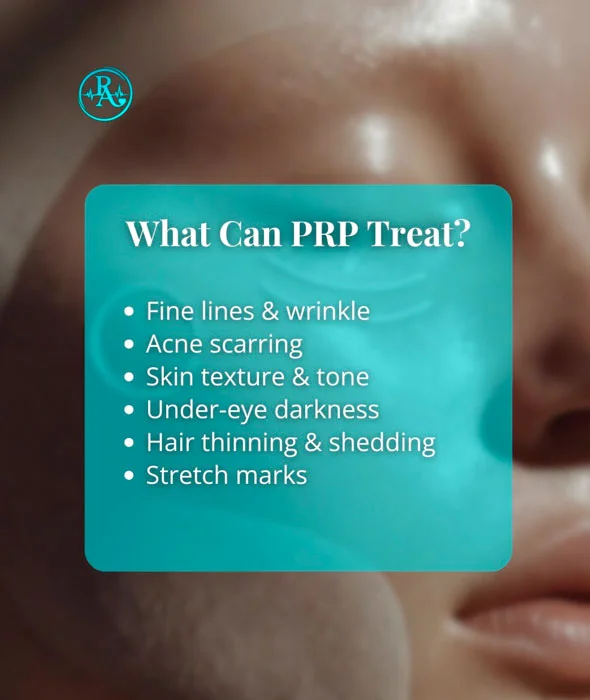 What can PRP treat