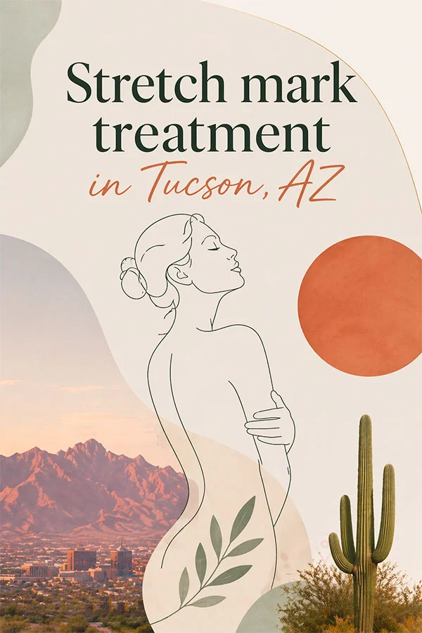 Stretch mark treatment in Tucson, AZ