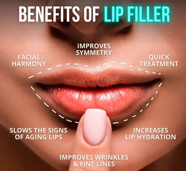 Benefits of lip filler