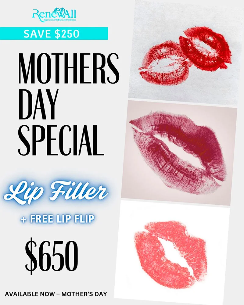 Mothers Day Special