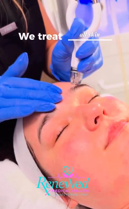 Facial SPA