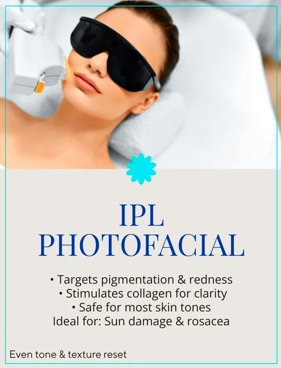IPL Photofacial