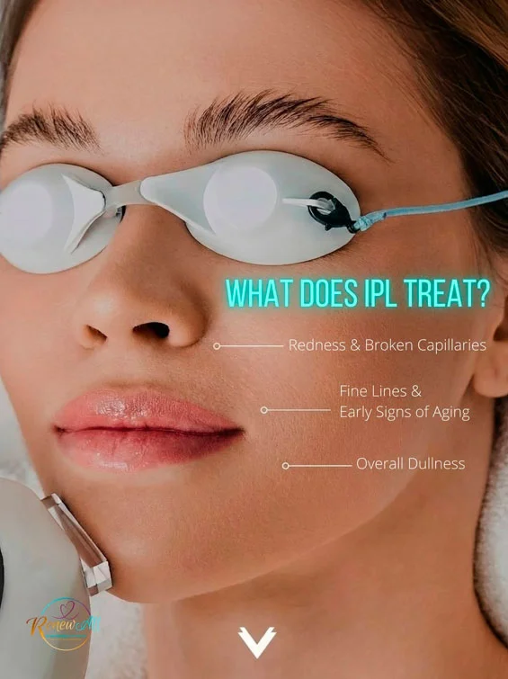 What does IPL treat