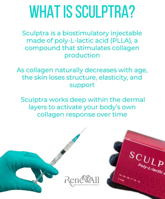 What is Sculptra